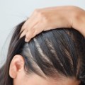 Exploring the Connection Between Lifestyle Factors and Female Hair Loss