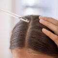 Serums and Oils for Hair Growth: How to Stop Baldness and Regrow Your Hair