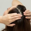 Scalp Treatments for Hair Growth: The Ultimate Guide