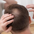 Conditioners for Hair Growth: How to Prevent Baldness and Promote Regrowth
