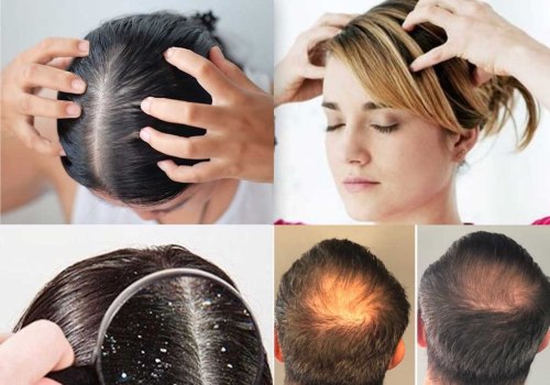 Scalp Massage for Hair Growth: A Comprehensive Guide