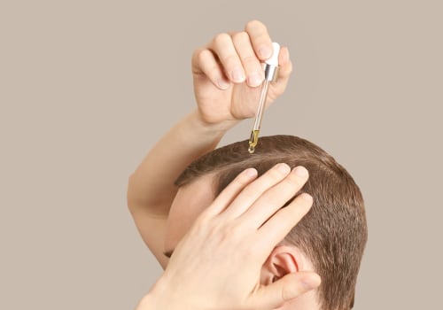 Hair Care Routine for Managing Male Pattern Baldness: Tips and Solutions