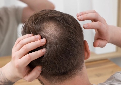 Conditioners for Hair Growth: How to Prevent Baldness and Promote Regrowth